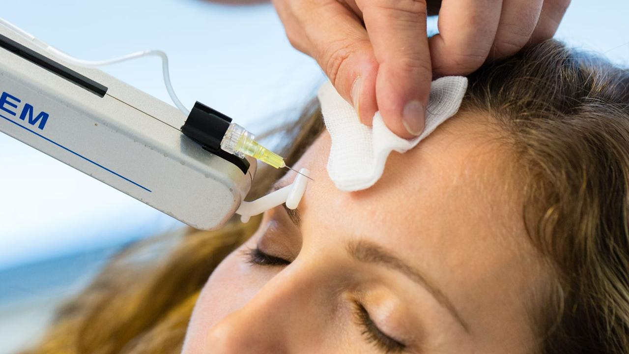 Mesolifting visage - Dr Belhassen