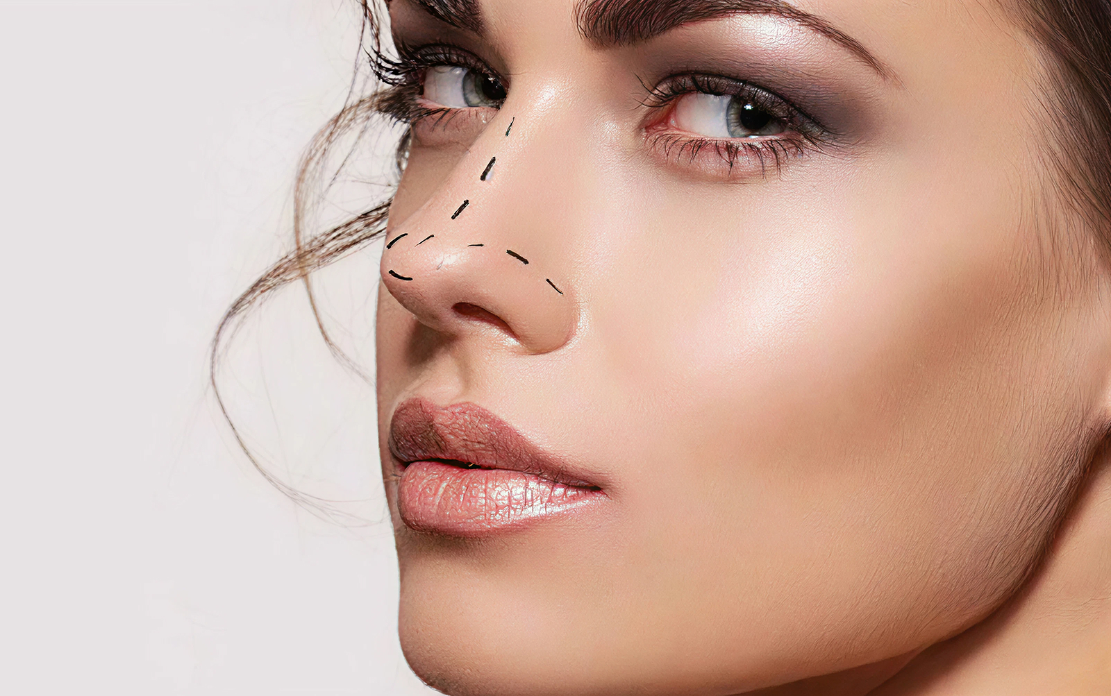 Rhinoplastie esthétique - Dr Belhassen