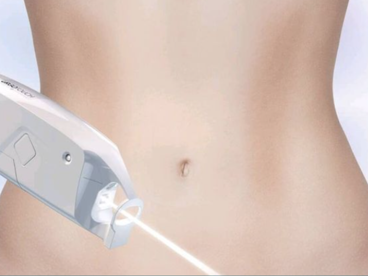 Laser Urgo Touch : pour de belles cicatrices post-chirurgie